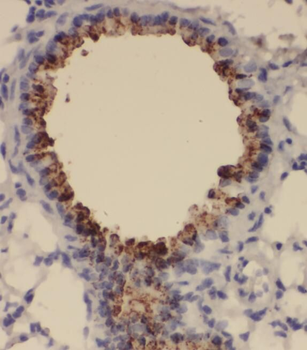 SNRPA1 Antibody