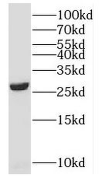 SNRPB Antibody