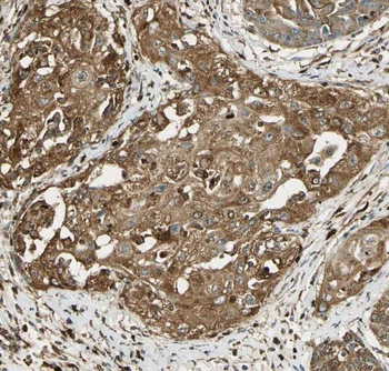 SNRPB Antibody