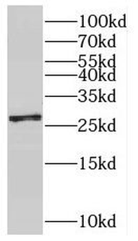 SNRPB2 Antibody