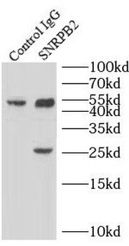 SNRPB2 Antibody