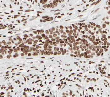 SNRPB2 Antibody