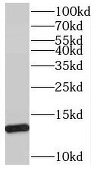 SNRPD1 Antibody