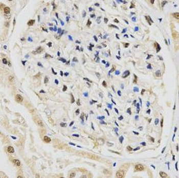 SNRPE Antibody