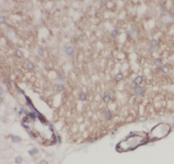 SNUPN Rabbit Polyclonal Antibody
