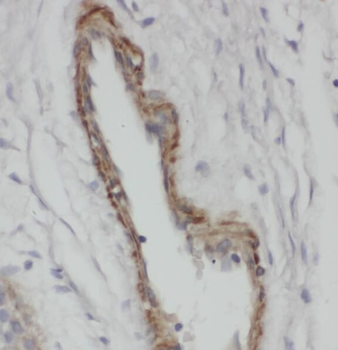 SNX1 Antibody