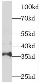 SNX20 Rabbit Polyclonal Antibody