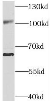 SNX25 Rabbit Polyclonal Antibody