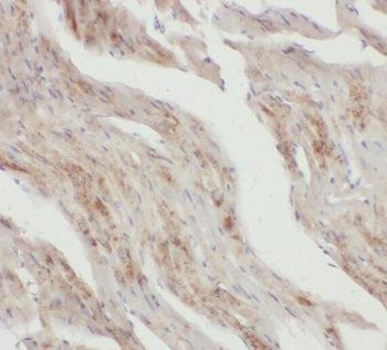 SNX6 Antibody