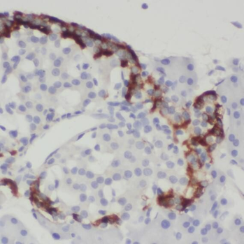 SNX7 Antibody
