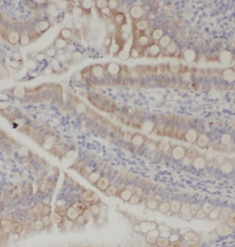 SOAT2 Antibody