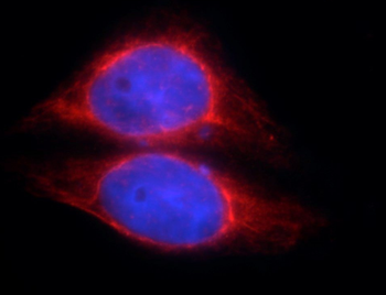 SOCS3 Antibody