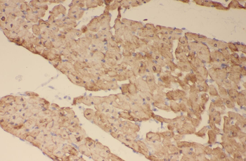 SOCS3 Antibody