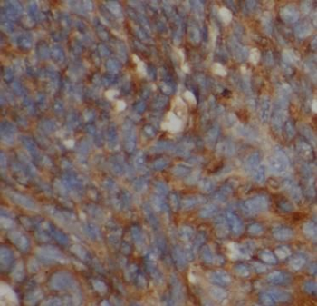SOD1 Antibody