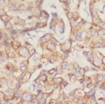 SOD2 Antibody