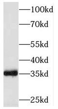SESTD1 Antibody