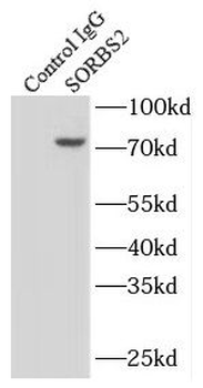 SORBS2 Antibody