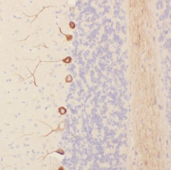 SORCS1 Antibody