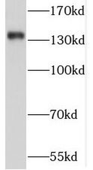SORCS2 Antibody