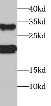 SOST Antibody