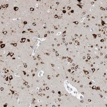 SOX10 Antibody
