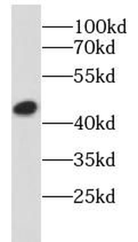 SOX17 Rabbit Polyclonal Antibody