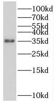 SOX2 Rabbit Polyclonal Antibody