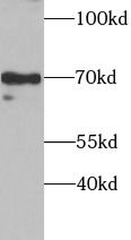 SOX5 Antibody