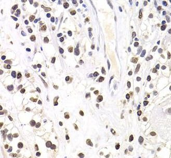 SOX5 Antibody