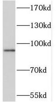 SOX6 Antibody