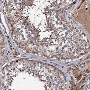 SPA17 Antibody
