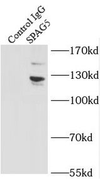 SPAG5 Antibody