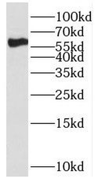 SPAG8 Rabbit Polyclonal Antibody