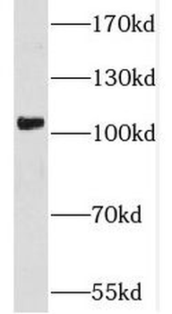 SPAG9 Rabbit Polyclonal Antibody