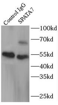 SPATA7 Antibody