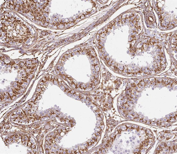 SPATA7 Antibody