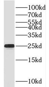 SPCS2 Antibody