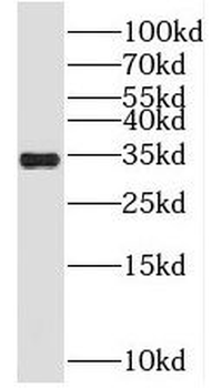 SRM Antibody