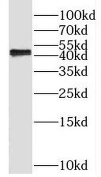 Phospho SPHK1 Rabbit Polyclonal Antibody