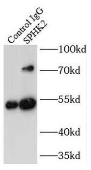 SPHK2 Antibody
