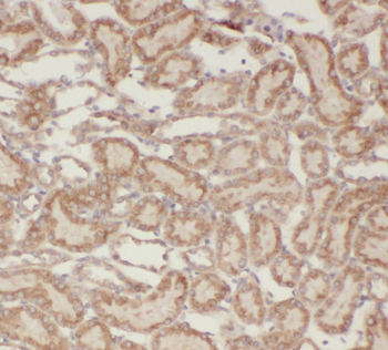 SPHK2 Antibody