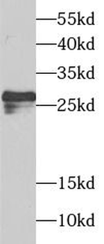 SPIN2B Antibody