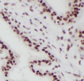 SPIN2B Antibody