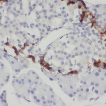 SPINK1 Antibody