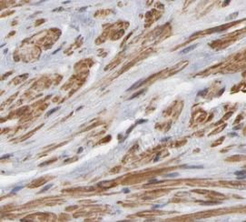 SPINT1 Antibody