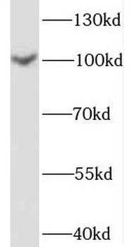 SPOCD1 Antibody