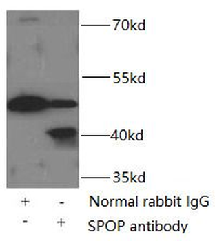SPOP Antibody