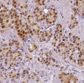 SPOP Antibody