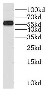 SPPL2A Antibody