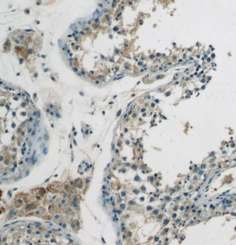 SPRED2 Antibody